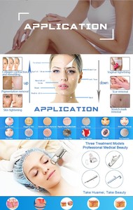 Máy <span class=keywords><strong>laser</strong></span> <span class=keywords><strong>CO2</strong></span> Fractional trị liệu vùng kín nữ mới nhất năm <span class=keywords><strong>2025</strong></span>, thiết bị cầm tay, dùng để làm săn chắc âm đạo - Product Image 6