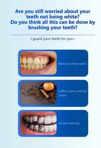 Kit de blanchiment des dents rechargeable portable Machine de blanchiment des dents dentaires avec charge 4USB Dispositif de blanchiment Lam à usage domestique - Product Image 4