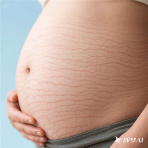 Crema Corporal para Embarazadas con Ácido Tranexámico y Arbutina que Ayuda a Mejorar la Textura y Elasticidad <span class=keywords><strong>de</strong></span> la Piel - Product Image 4