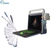 Taşınabilir Çelik Diagnostik Ekokardiyografi Ultrason Cihazı Ekograf Cihazı Renkli Doppler CU60B Dahili Bataryalı 1 Yıl Garantili