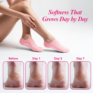 Calzini in Gel di Silicone Riutilizzabili Anti-Screpolature e Idratanti per la Cura dei Piedi Femminili, per <span class=keywords><strong>Talloni</strong></span> Screpolati - Product Image 5
