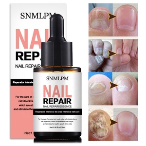 Etiqueta privada Nail Foot Protector Nail Fungus Tratamiento Reparación de uñas para infecciones fúngicas dañadas - Product Image 3