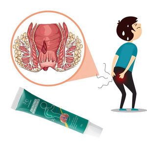 Pomada antihemorroidal <span class=keywords><strong>para</strong></span> el cuidado de la salud, bálsamo <span class=keywords><strong>para</strong></span> <span class=keywords><strong>hemorroides</strong></span>, crema <span class=keywords><strong>para</strong></span> pilas externas internas, remedio eficaz <span class=keywords><strong>para</strong></span> la eliminación de <span class=keywords><strong>hemorroides</strong></span> - Product Image 3
