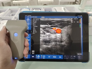 DMU86 カラー ドップラー ワイヤレス プローブ ハンドヘルド ワイヤレス 超音波スキャナー リニアプローブ 最安値 - Product Image 4