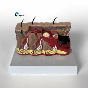 Modello Anatomico di Bruciature Cutanee con Codifica a Colori per Tessuti Normali e Bruciature di Terzo Grado, Modello Didattico per l'Educazione in Dermatologia - Product Image 1