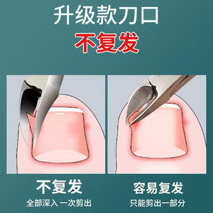 Stainless Steel Eagle Beak Nail Clipper Set Portable Star Shaped Trimmer Cuticle Remover Pedicure Tool For Adults - Product Image 5