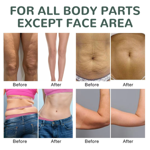 Crema Hidratante Reafirmante y Nutritiva con Colágeno <span class=keywords><strong>de</strong></span> Marca Privada, <span class=keywords><strong>Beneficios</strong></span> Blanqueadores, Aceite Esencial Compuesto Prensado en Frío - Product Image 3