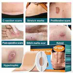 เทปซิลิโคนปิดแผล, แผ่นซิลิโคนปิดแผล (2 ม้วน-6 เมตร), แผ่นปิดแผลเกรดทางการแพทย์สำหรับแผลผ่าตัด, แผ่นปิดแผลแบบใช้ซ้ำได้ - Product Image 4