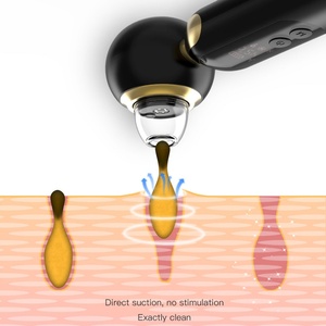 Removedor de Puntos Negros Eléctrico Frío y Caliente, Dispositivo de Eliminación de Manchas Oscuras, Productos de Belleza para Mujeres - Product Image 5