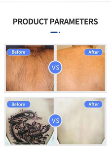 Máquina de enfriamiento de piel de alto rendimiento con aire frío para tratamiento láser en salones de belleza profesionales, anti-quemaduras y alivio del dolor. - Product Image 3