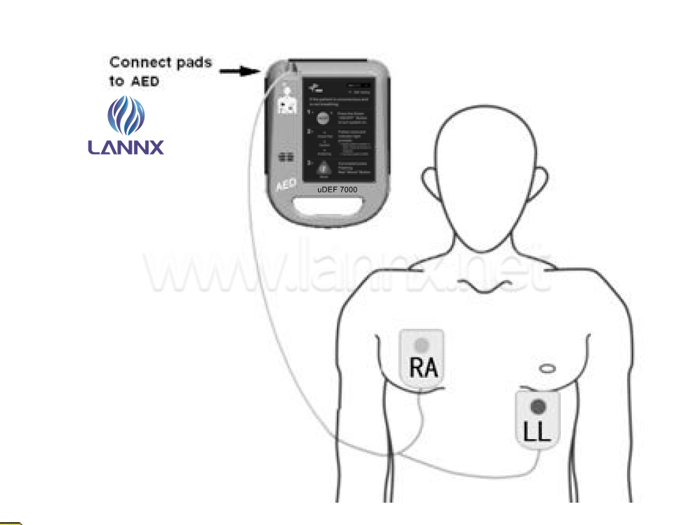 MÁY HUẤN LUYỆN KHỬ RUNG TIM - AED TRAINING