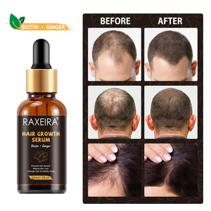 Sérum Capillaire Essentiel Croissance et Épaississement du Cheveu <span class=keywords><strong>Anti</strong></span>-<span class=keywords><strong>Chute</strong></span> Ginseng Gingembre Biotine pour Alopécie, Marque Blanche Vente en Gros - Product Image 6