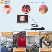 Ureteroscopio Eléctrico Flexible Desechable de 7.5FR y 8.5FR para Instrumentos Quirúrgicos Digitales Médicos, con Sensores de Imagen y Cámara para Hospitales