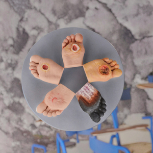 Набор анатомических моделей стопы для изучения диабетической стопы, медицинский образовательный инструмент - Product Image 3