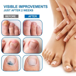 Crème d'entretien des ongles personnalisée avec logo, 20g, crème à base de plantes pour l'entretien quotidien des ongles des mains et des pieds - Product Image 4