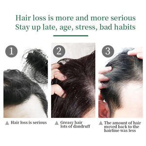 Minyak Esensial Pertumbuhan Rambut Herbal Vegan Organik Alami 100ml, Cocok untuk Karakteristik Rambut Tipis dan Mengembang - Product Image 5