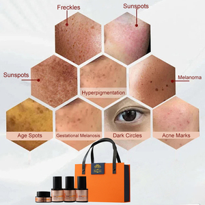Iperpigmentazione causata da metalli pesanti nei cosmetici 4 In1 macchia della pelle Melasma per la pigmentazione del viso Peel rimuovere il Set di trattamento - Product Image 4