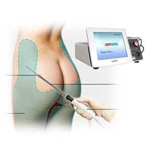 Endolaser 980 1470Nm Diodo Láser Abdomen <span class=keywords><strong>Brazos</strong></span> Mandíbula y Cuello Levantamiento 1470Nm Láser 980Nm Láser para liposucción Máquina de estiramiento corporal - Product Image 3