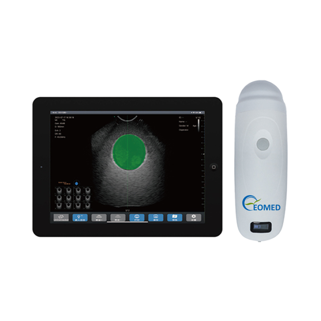 High Accuracy 4D Wireless Bladder Scanner Urology Handheld Bladder Scanner Portable Bladder Scanner Veterinary Human B10