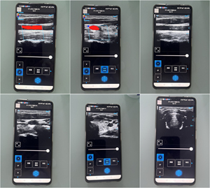 Di động cầm tay không dây siêu âm 3 trong 1 siêu âm DOPPLER màu Wifi đầu dò máy siêu âm - Product Image 5