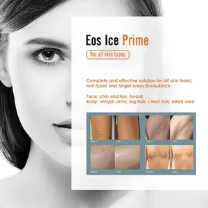 Eos Ice-جهاز إزالة الشعر بالليزر, آلة إزالة الشعر بالليزر ، 3000 واط ، معدات إزالة الشعر ، جهاز إزالة الشعر الاحترافي بالليزر