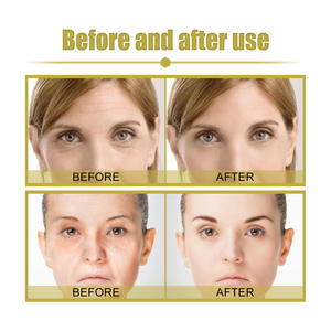 Vente en gros EELHOE raffermissement de la peau ralentir le processus de vieillissement meilleure construction de la peau sérum anti-âge - Product Image 4