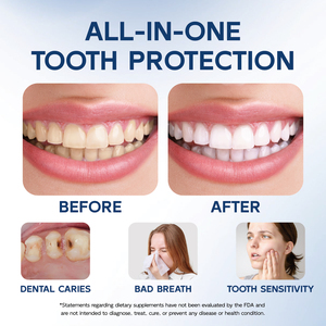 Protezione dalle carie: il Tooth Armor Liquid aiuta a rinforzare i denti, allevia la sensibilità, sbianca i denti, routine di igiene orale quotidiana. - Product Image 4
