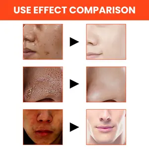 ตะวันออกดวงจันทร์ทําความสะอาดลึกป้องกันสิวหัวดําRemoverภูเขาไฟRock Foamingครีม<span class=keywords><strong>ล้าง</strong></span><span class=keywords><strong>หน้า</strong></span>ที่ดีที่สุดผู้ชายล้างหน้า - Product Image 6