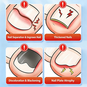 Solution antibactérienne à l'acide acétique, pour le traitement des infections fongiques des pieds, solution pour <span class=keywords><strong>bain</strong></span> <span class=keywords><strong>de</strong></span> pieds, exfoliation, démangeaisons, onychomycose - Product Image 2