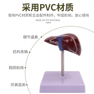 Modèle de pathologie hépatique, modèle de foie gras, modèle hépatobiliaire, foie malade, modèle d'anatomie hépatique humaine simulée - Product Image 2