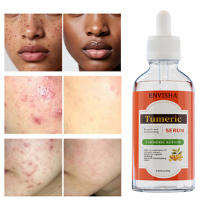 Etiqueta privada Orgánica Vegana Nutritiva <span class=keywords><strong>Borrador</strong></span> <span class=keywords><strong>de</strong></span> manchas oscuras Iluminador Incluso Blanqueamiento Suero facial <span class=keywords><strong>de</strong></span> cúrcuma - Product Image 2