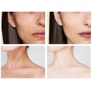 Jabón Blanqueador Artesanal para el Cuidado de la Piel, Limpieza Profunda, Hidratante, Jabón Esencial Suave, Aclara la Piel, Jabón con Ácido Kójico - Product Image 4