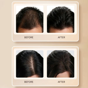 Champú Orgánico a Base de Hierbas Personalizado <span class=keywords><strong>para</strong></span> el Crecimiento del Cabello y Tratamiento Nutritivo Anticaída <span class=keywords><strong>para</strong></span> un Crecimiento Rápido, <span class=keywords><strong>para</strong></span> Hombres y Mujeres, OEM - Product Image 3