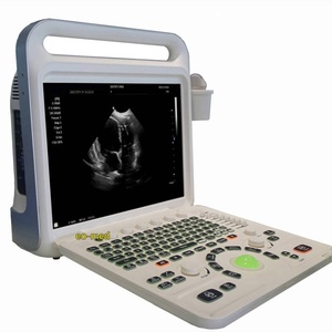 Appareils d'échographie portables, instruments et scanners d'échographie médicale, scanner d'échographie Doppler CU60 - Product Image 2