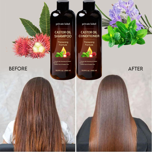 Shampoo et revitalisant à l'huile de ricin personnalisés en gros - un ensemble anti-chute de cheveux Formule épaississante pour lutter contre l'amincissement et les pellicules - Product Image 3