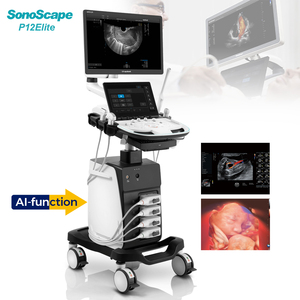 Ecógrafo Sonoscape P12 Elite, Máquina de Ultrasonido, Instrumentos Médicos de Ultrasonido para Hospitales - Product Image 2