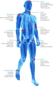 Curelas Dual-Wellenlängen 810nm 980nm Veterinär-Physikalische Lasertherapiegerät für Mensch und Tier zur Schmerzlinderung - Product Image 3