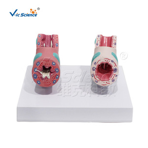 Suministro directo de fábrica de modelos de patología traqueal, hechos de material de PVC ecológico, claramente identificados, para laboratorio. - Product Image 1