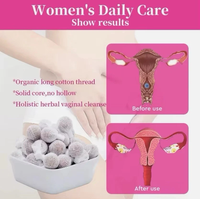 Perles de désintoxication vaginale originales, nettoyage utérin, antibactérien, contrôle des odeurs, soins vaginaux, 10 capsules par sachet, herbes chinoises du Shaanxi