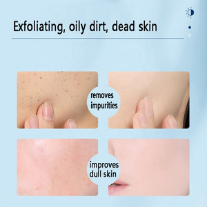 <span class=keywords><strong>Gel</strong></span> exfoliant pour le visage à l'acide de fruits en marque propre, <span class=keywords><strong>gel</strong></span> de soin de la <span class=keywords><strong>peau</strong></span> à l'acide aminé, nettoyage doux, <span class=keywords><strong>gel</strong></span> facial - Product Image 2