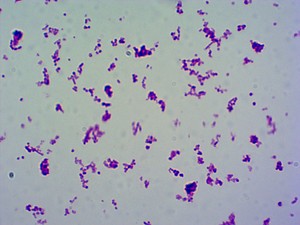Portaobjetos de Microscopio con Algas y <span class=keywords><strong>Hongos</strong></span> para la Enseñanza de Biología en Secundaria, Especímenes Preparados con Estructuras Fúngicas Típicas, ISO - Product Image 2
