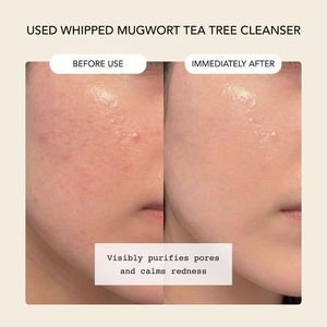 Limpiador Facial con Extracto Herbal, Limpieza Suave, Antiacné, Hidratante, Control de Grasa y Limpieza de Poros - Product Image 2