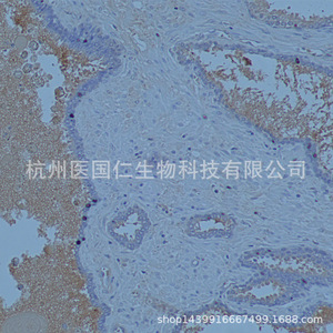 Immunohistochemistry Tissue Sample Pathology Service Paraffin Sections Cell Slides Frozen Sections Biotechnology Lab Reports - Product Image 3