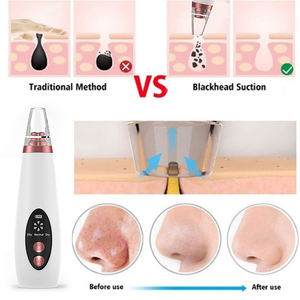 Cheap USB Rechargeable Skin Care Facial Tools Acne Cleaner Pimple Removal <b>Face</b> Nose Blackhead Remover <b>Face</b> Pore Vacuum - Product Image 5