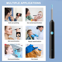 Nettoyeur d'oreilles visuel sans fil intelligent, rechargeable, type-C, endoscope électrique, outil d'élimination de la cire, 6 lumières LED, cure-oreilles avec caméra HD