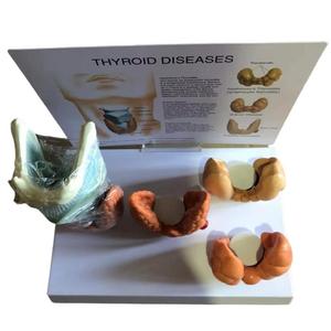 Modello di patologia tiroidea endocrinologia modello di visualizzazione della malattia della tiroide venduto come modello anatomico di scienza medica - Product Image 3
