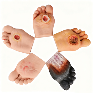 Enseñanza médica Modelos de pie diabético <span class=keywords><strong>en</strong></span> los niveles 1 a 5 Mostrar recursos experimentales de enseñanza - Product Image 5