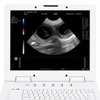 Système de diagnostic échographique Doppler couleur vétérinaire JL-VPD3, scanner de classe II pour chiens et chats
