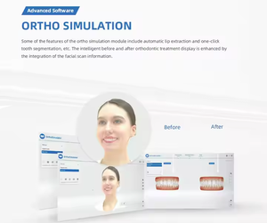 Nueva llegada <span class=keywords><strong>Dental</strong></span> <span class=keywords><strong>Shining</strong></span> 3D Face <span class=keywords><strong>Scanner</strong></span> Smile Máquina médica de alta frecuencia para equipos de sistemas de cámaras digitales - Product Image 3