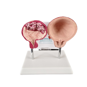 Comparación de Órganos Viscerales Normales con Corazón, Pulmón, Vejiga, Vasos, Tráquea Oral, Modelo Médico Fetal - Product Image 1